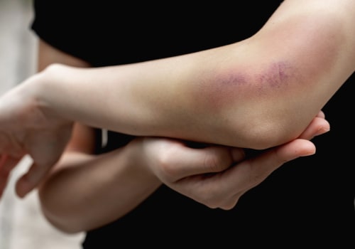 What are two main causes of vitamin deficiency?